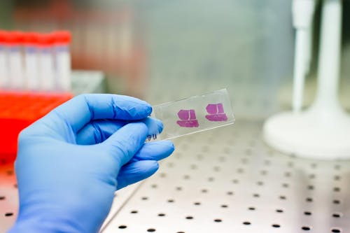 Scoperto un nuovo punto debole dell'epatocarcinoma