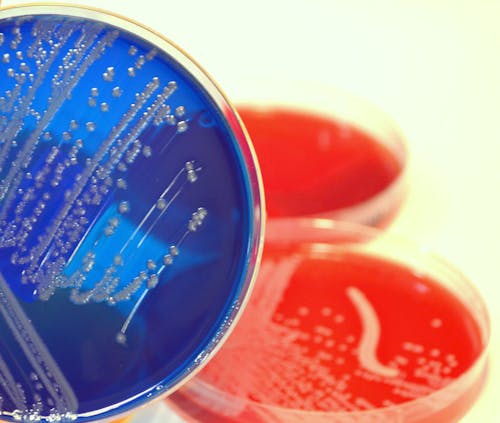 Il sorprendente ruolo dei batteri intestinali nella progressione del mieloma multiplo